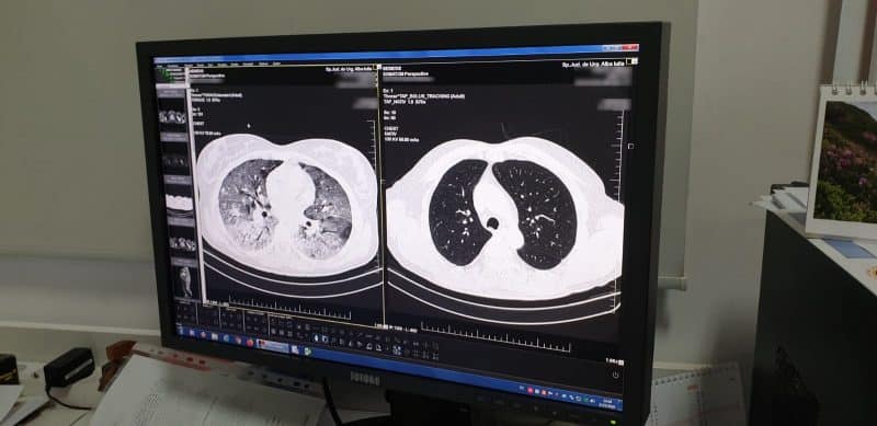 24 martie, Ziua Mondială a Tuberculozei. Data care a schimbat lupta împotriva TBC