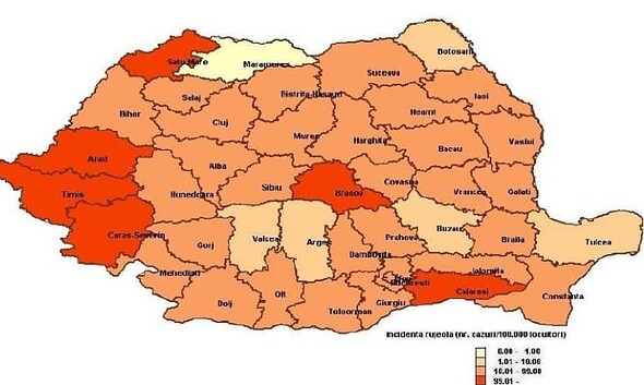 harta rujeola