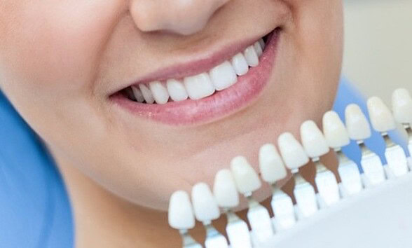 albire dinti