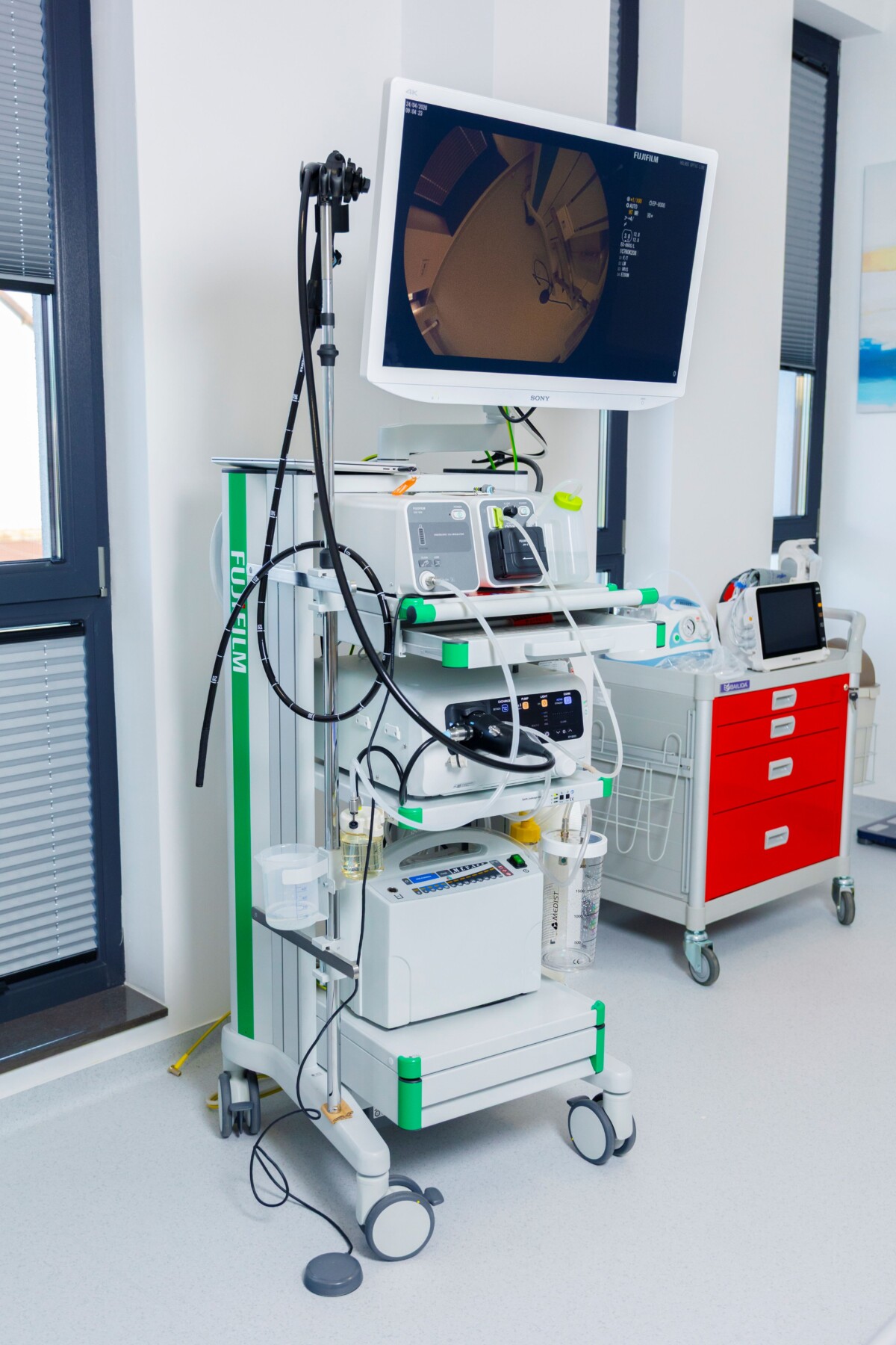 spital dr. holhos alba iulia gastroenterologie